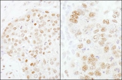 CPSF73 Antibody, Novus Biologicals 0.1mL; Unlabeled:Antibodies, Polyclonal